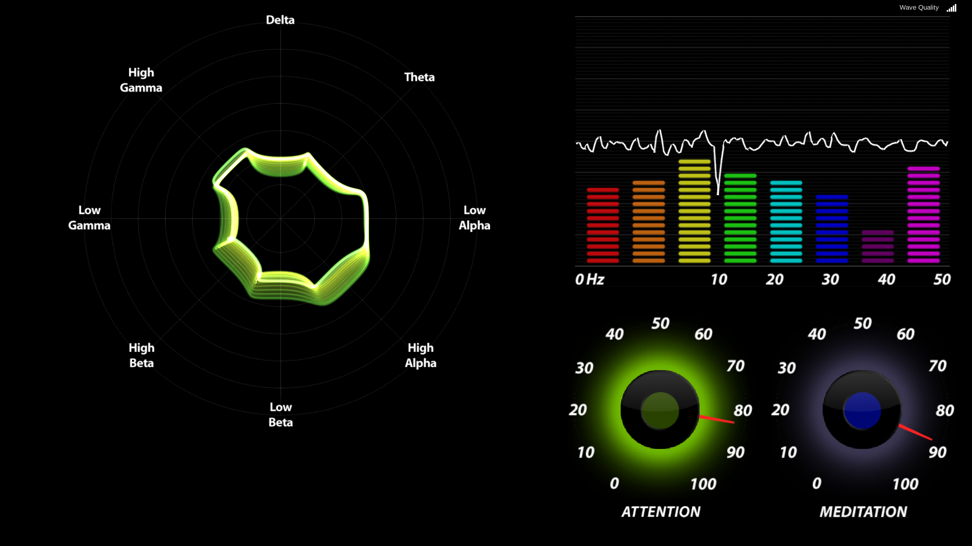 EEG Neurofeedback