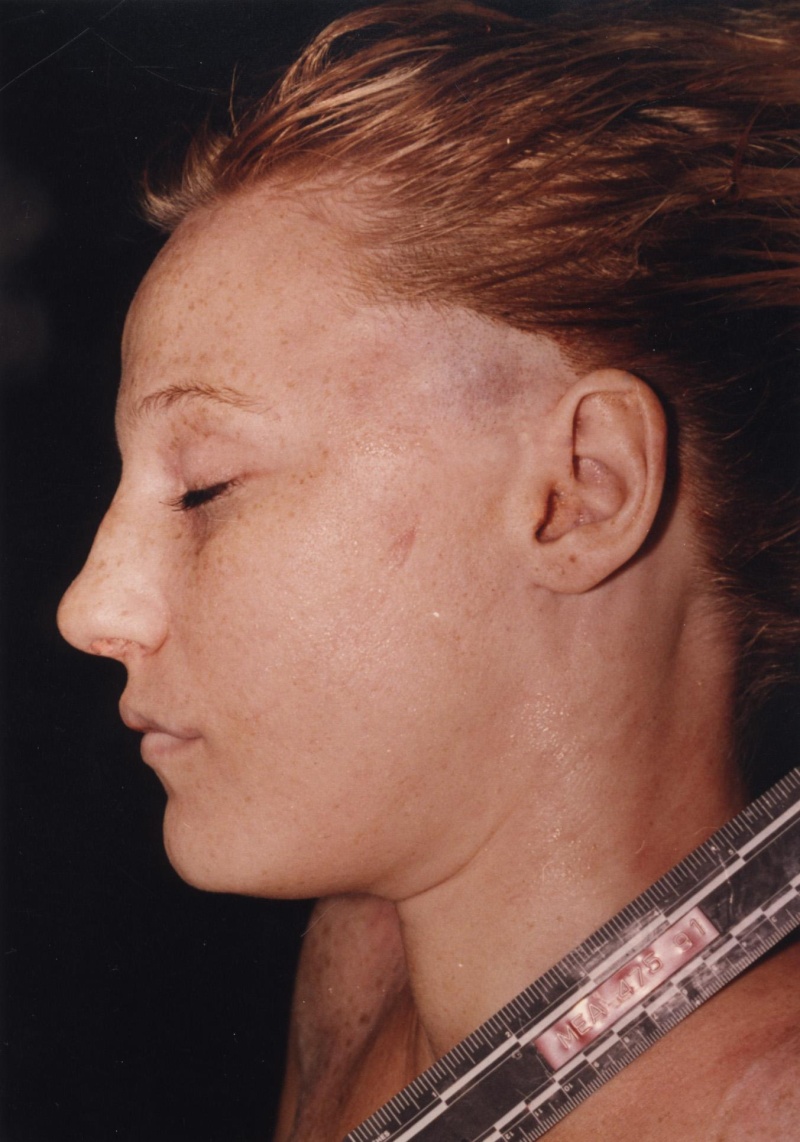 doe99310.jpg