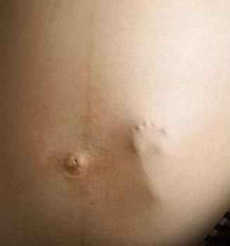 753159997_baby_foot_womb_xlarge.jpeg