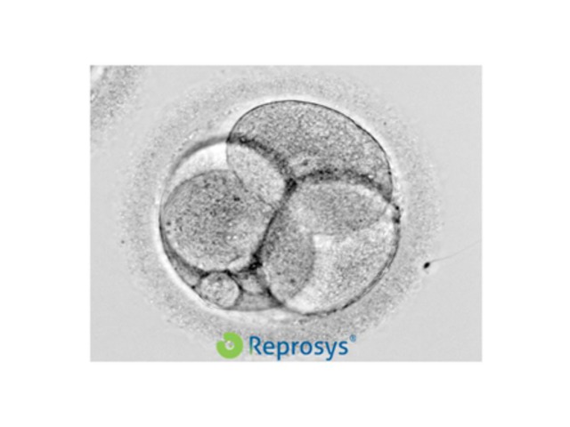EmbrioBlog
