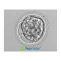 Az embriók gyorsfagyasztása- Vitrifikáció