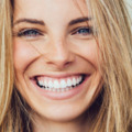 Was kostet ein perfektes Lächeln? Preise und Finanzierungsmöglichkeiten für Lumineers. 