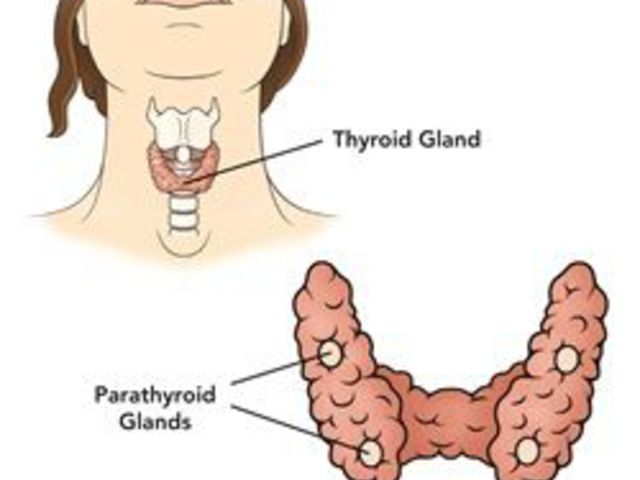 Amenorrea por tiroides