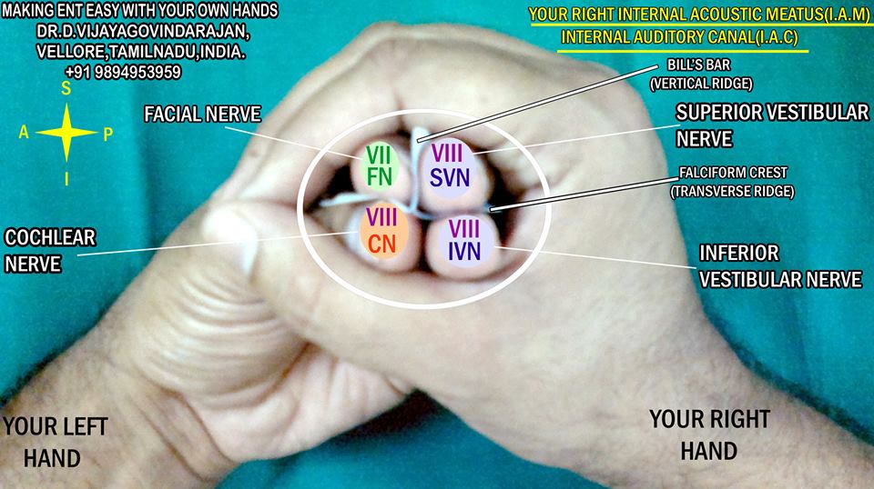 INTERNAL ACOUSTIC MEATUS.jpg