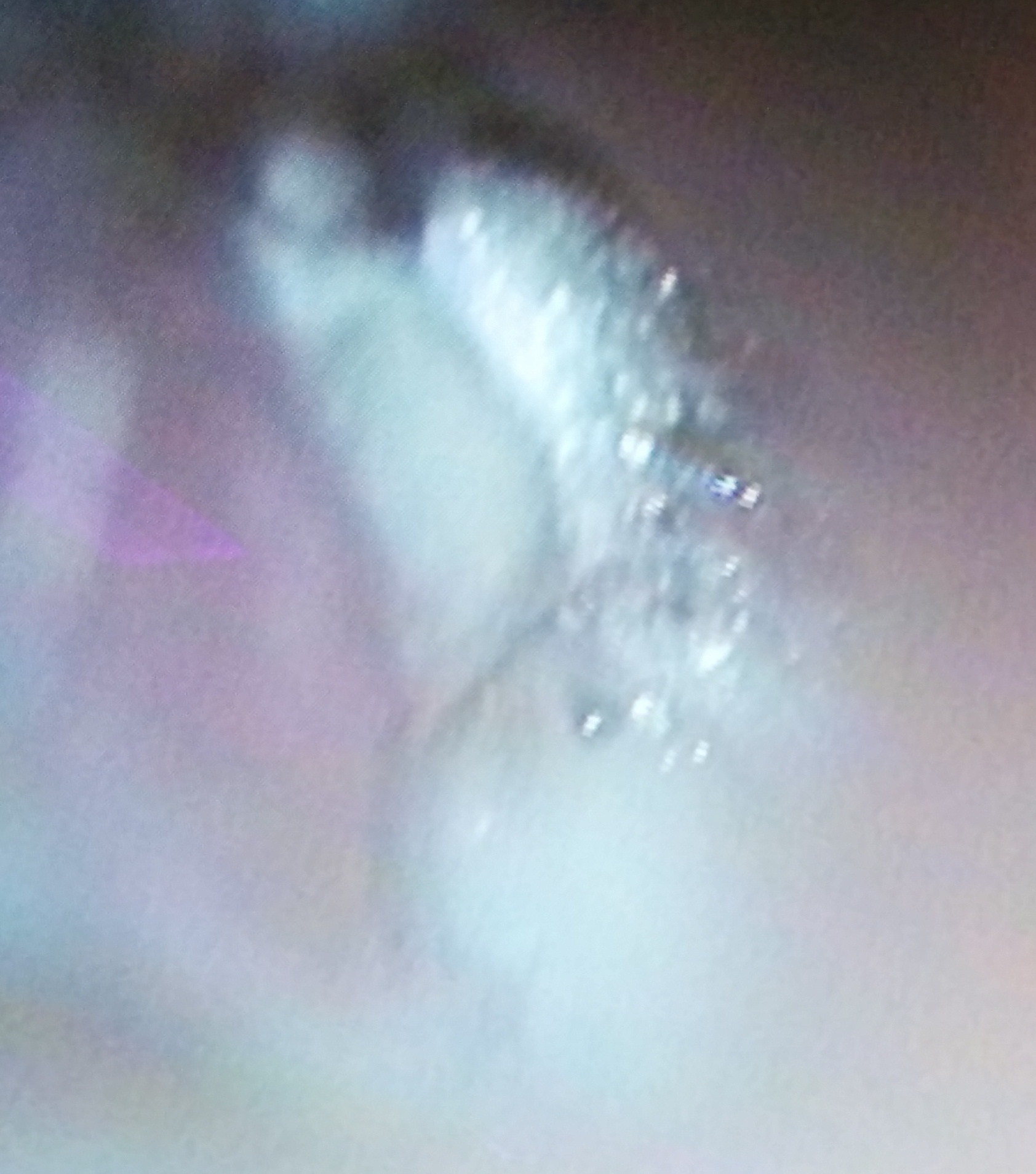 mycotic external otitis.jpg