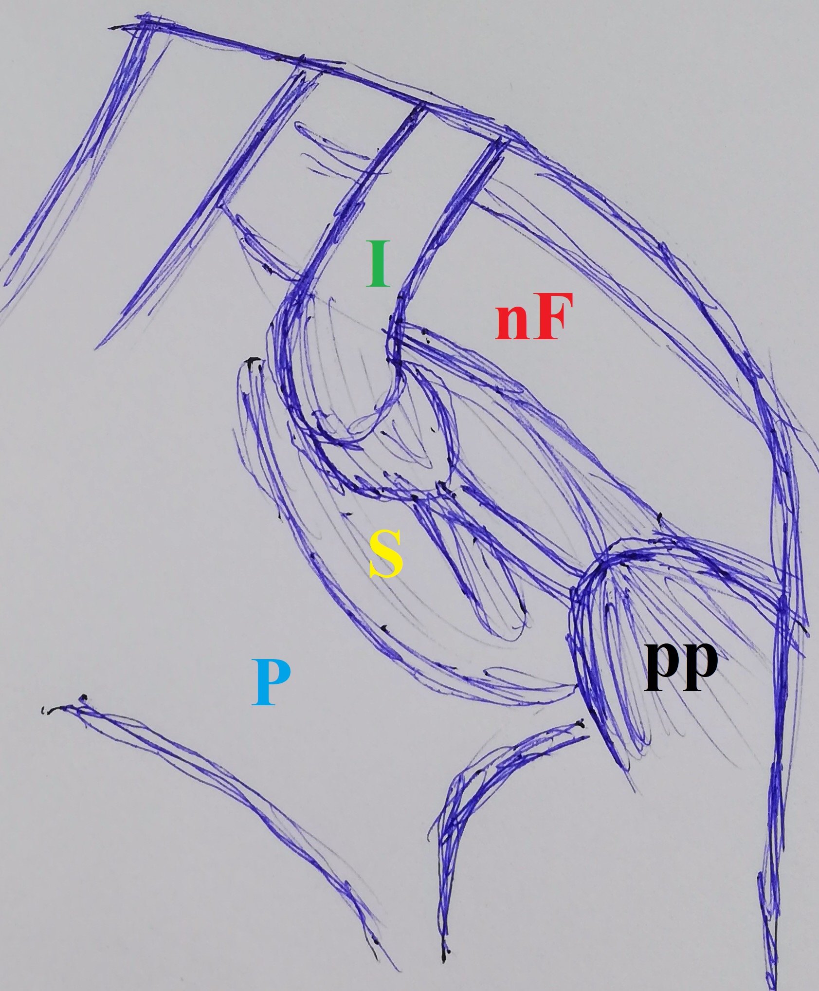 facial_nerve_dehiscence.jpg