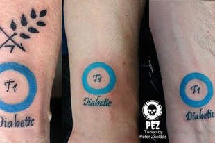 Életmentő tetoválást készítenek magyar tetoválók! #értékesötletek