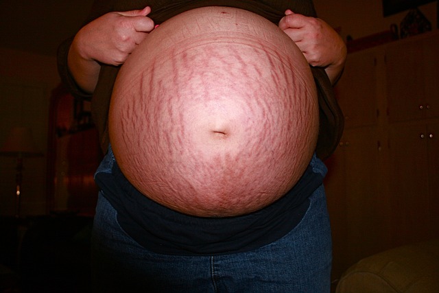 pregnant-1577212_640.jpg