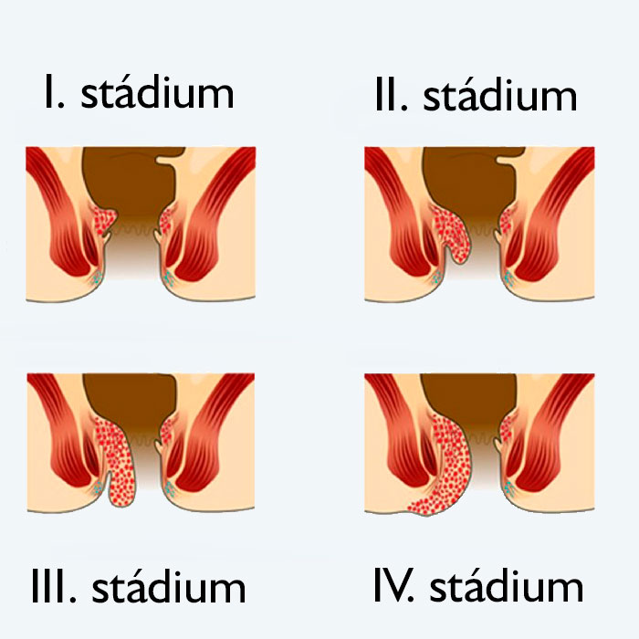 aranyer_stadiumok.jpg