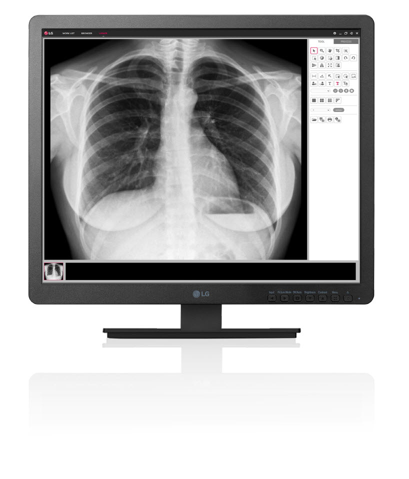 clinical_review_monitor_model_19hk312c.jpg