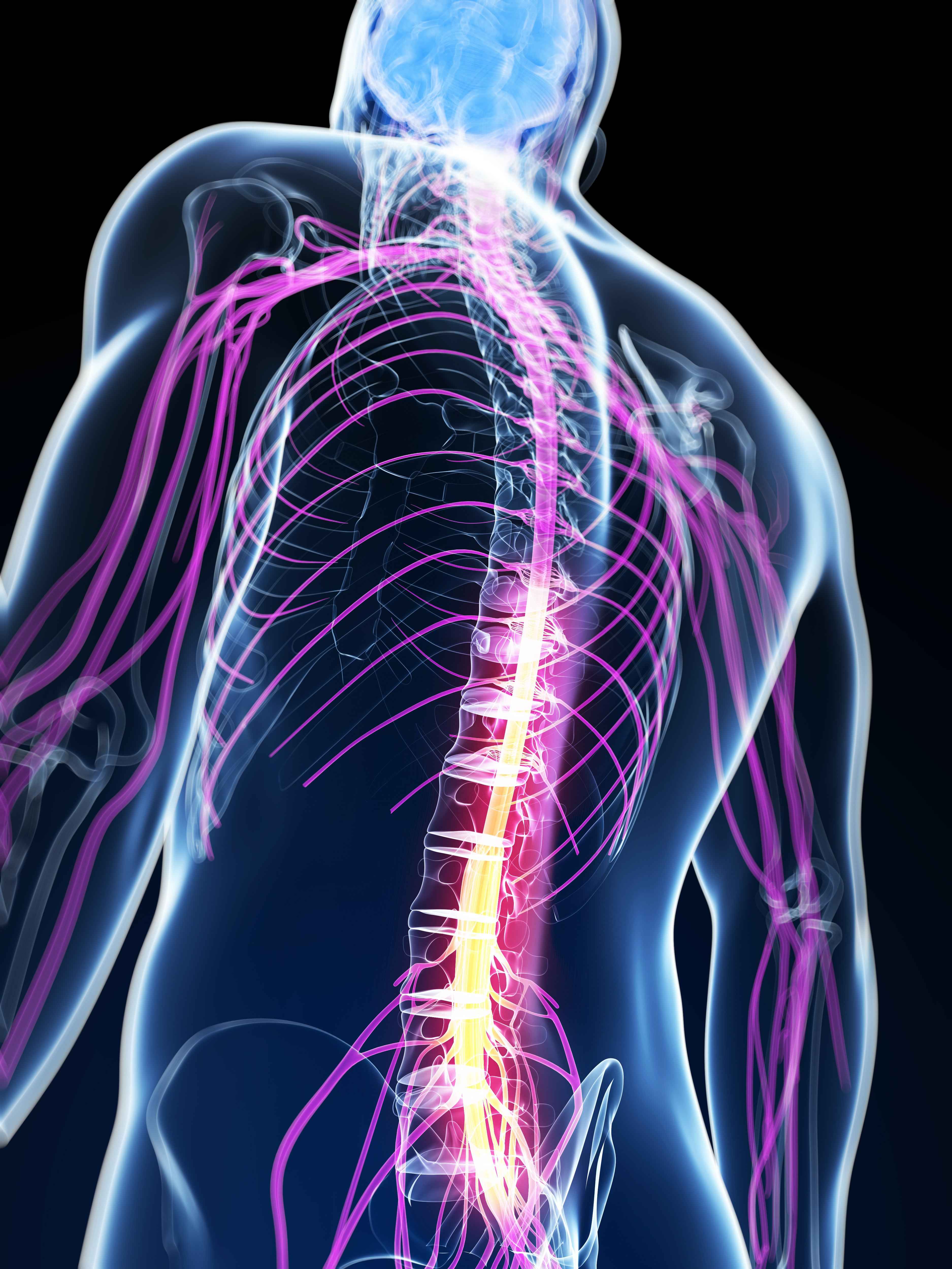 spinal-cord-stimulation.jpg