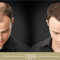 A megoldás hosszú időre (Toppík)