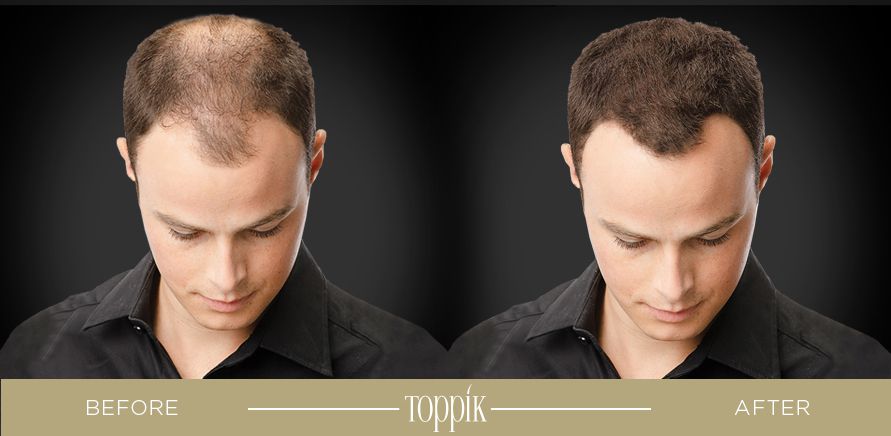 toppik1.jpg