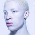 albínó néger egy szál punciban és más zavaros fesztiválsztorik XD