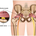 A Piriformis izom nyújtása (Isiász esetén ezt imádni fogod!)