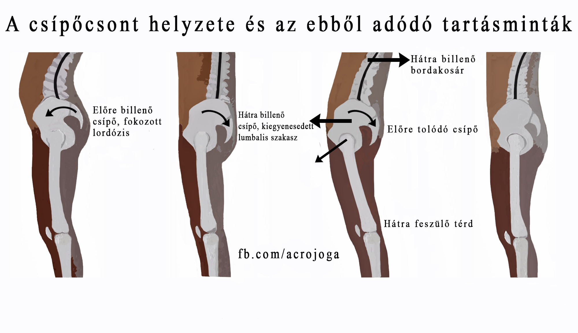 Ülőgumó fájdalom