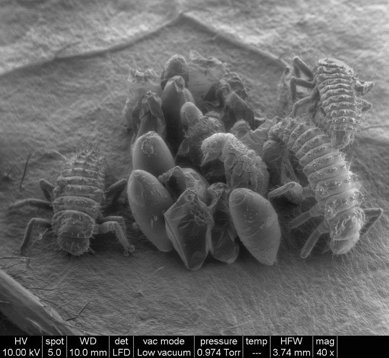 birth-of-ladybugs-macro-microscope-photograph-riccardo-antonelli.jpg