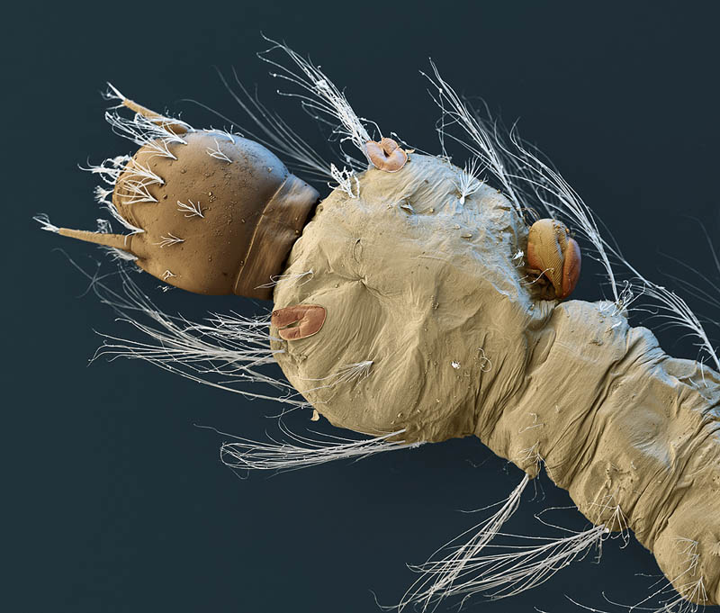mosquito-larva-with-parasite-electron-microsope-image-nicole-ottawa.jpg