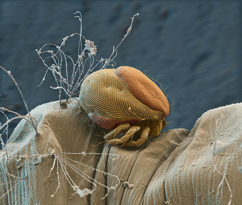 parasitic-mite-on-mosquito-larva-nicoe-ottawa.jpg