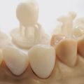 A 3D nyomtatás előnyei a fogászatban