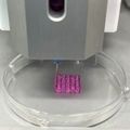 3D bionyomtatással gyógyíthatóbb lesz a rák?