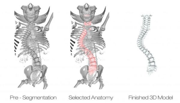 3dnyomtatas_anatomia.jpg