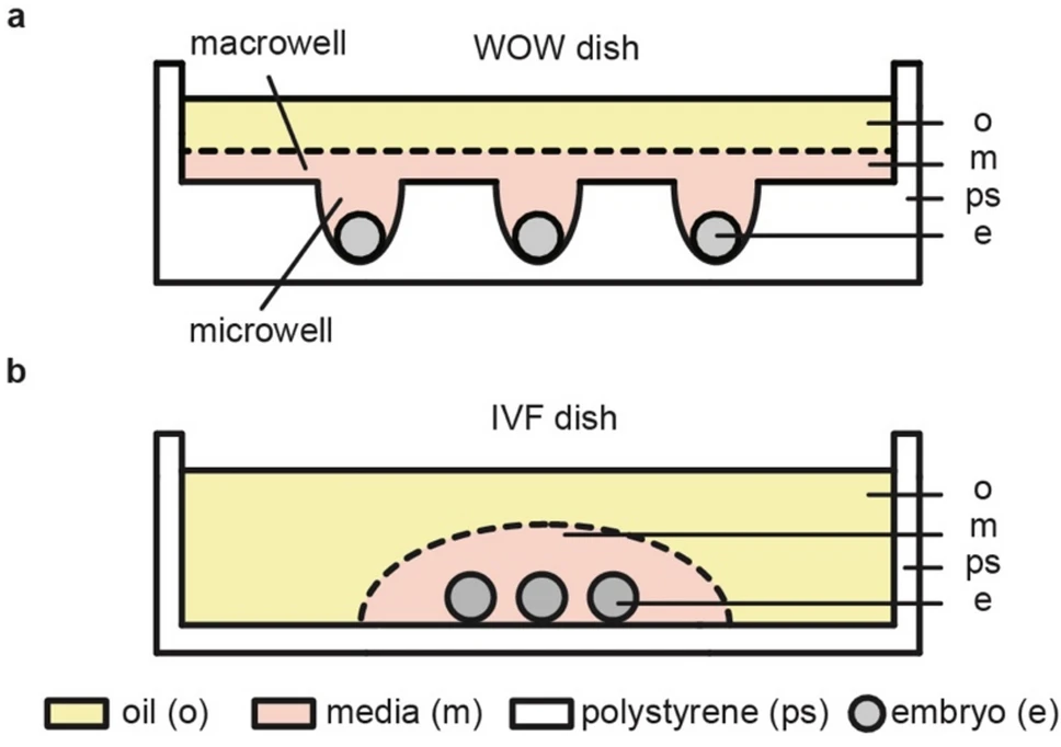 ivf-1l.webp