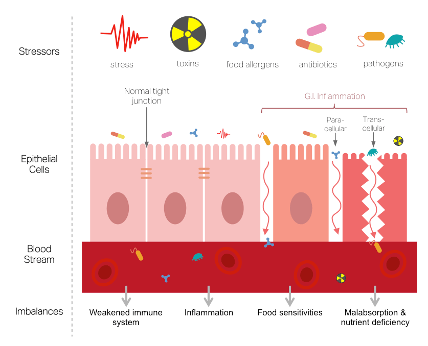 leaky-gut-diagram-1.png