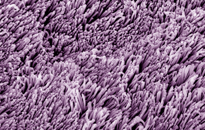 Fig.-1-cilia-SEM.gif