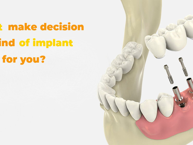 How to find a Good dental office in Budapest?