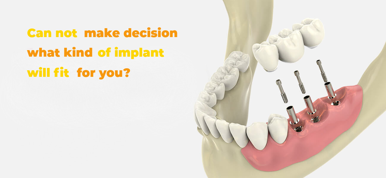 what-kind-of-implant-fit-for-you.jpg