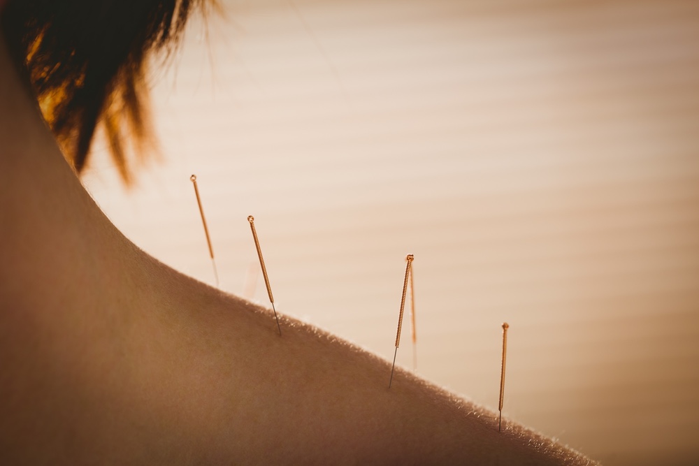 gerinces-akupunktura3.jpg