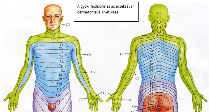 gerinces_gyöki fájdalom.jpg