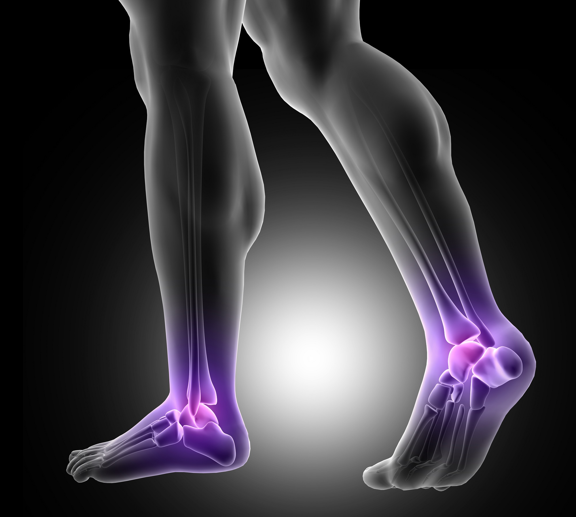 hogyan kezeljük a láb artrózisát 2 fokkal térd reumás ízületi gyulladás, mint a kezelés