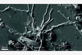Épen maradt neuronok herculaneumi áldozat megüvegesedett agyában