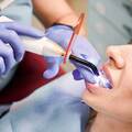 A fogászati lézeres kezelések korszaka: A modern fogászat forradalma
