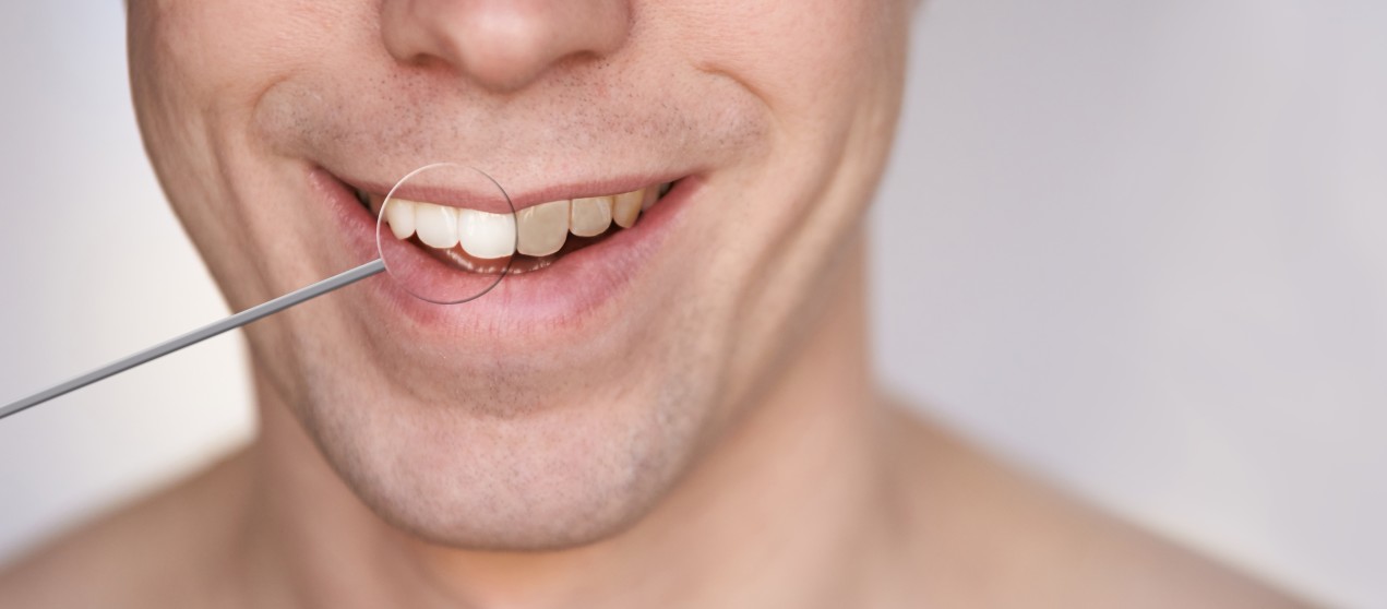 men-smile-male-smiling-person-whitening-oral-care-concept-teeth-before-and-after-laughing-mouth_t20_jljplz.jpg