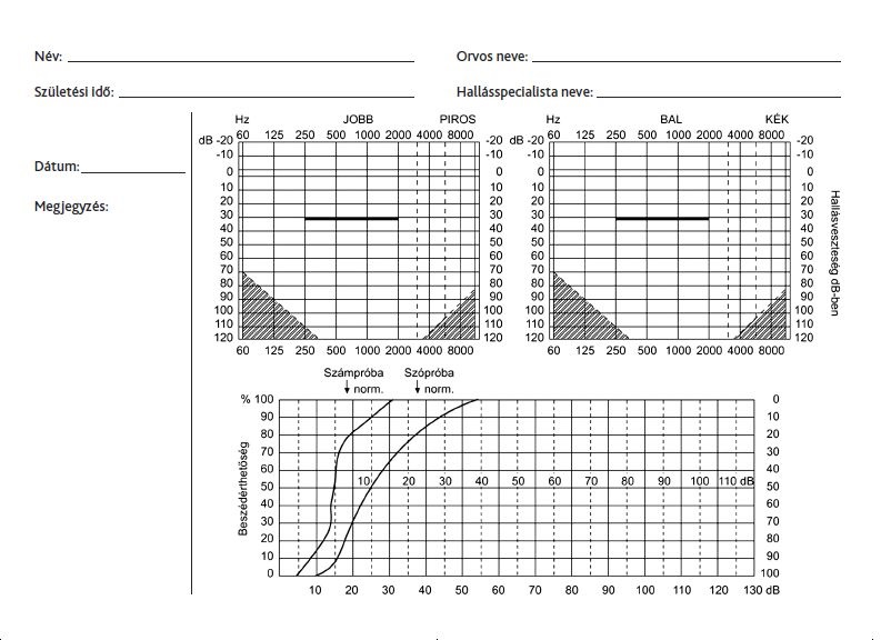 audiogram.jpg