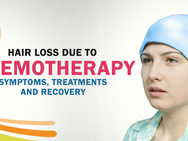 Do not postpone chemotherapy over the fear of losing hair