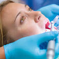 A fogászati kezelés és a fogszuvasodás