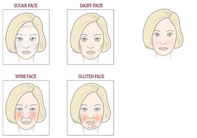 Milyen elváltozásokat okoznak az étkezési szokások az arcon? - Hipochonder blog