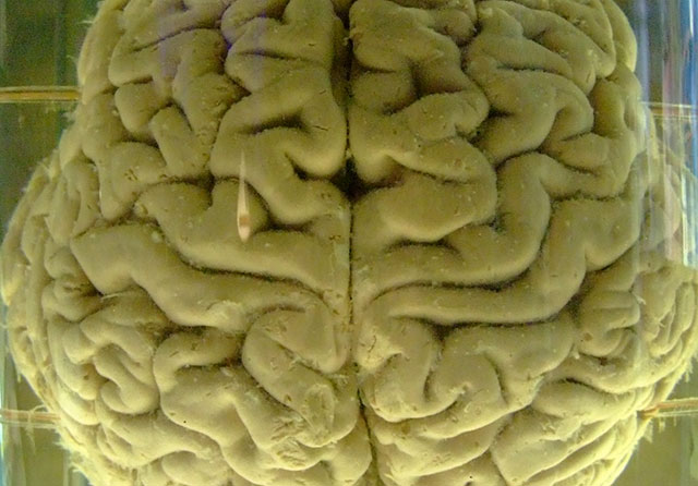 famous-missing-brains.jpg