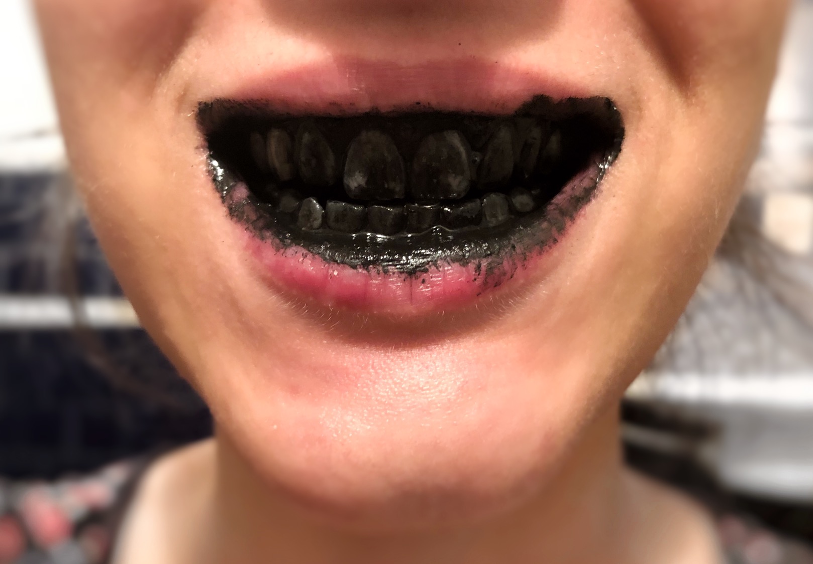 Fekete porral hófehér fogak? Tényleg működik? - SmileOn teszt