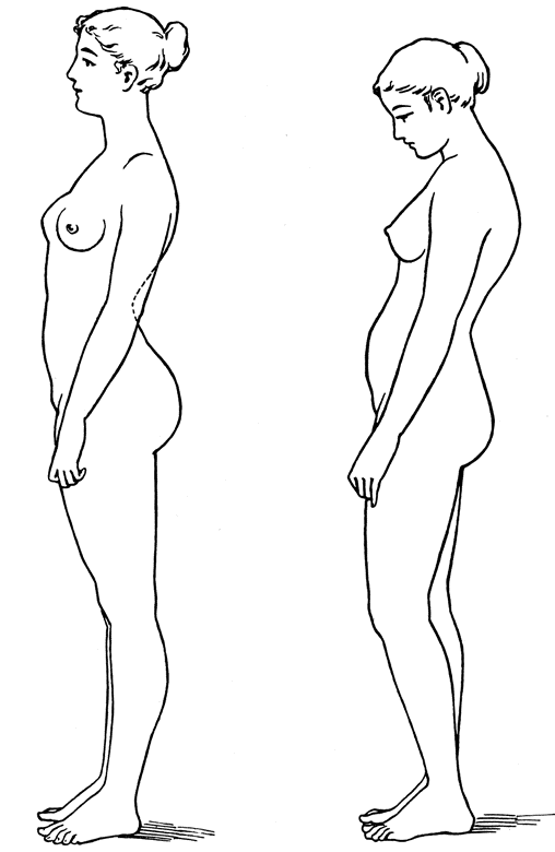 Posture Comparison.gif