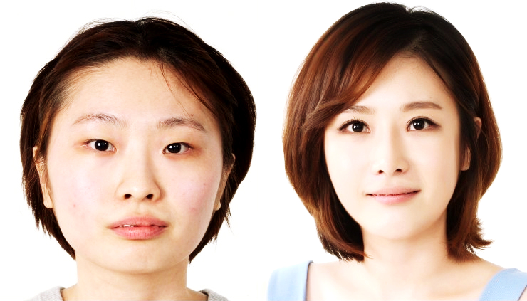 south-korean-plastic-surgery.jpg