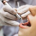 Unlocking Smiles: The Perks of Choosing a Dental Clinic in Budapest