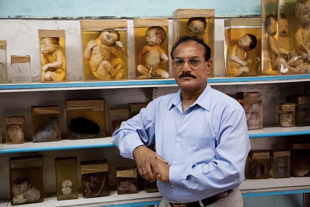 bhopal-dksatpathy-fetuses-2009-1024.jpg