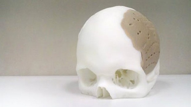 3dskull[1].jpg