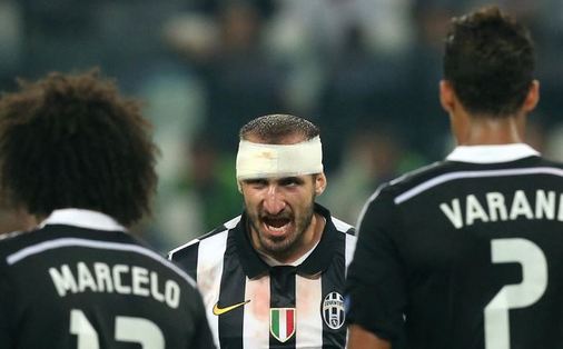 chiellini_giorgio_turbanban_real_ellen.JPG