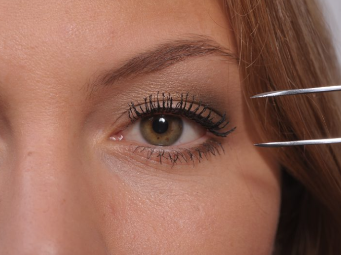 Biztonságos a szemhéjplasztika? Orvosi tanácsok és kockázatok
